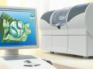 CEREC 3D dentistry
